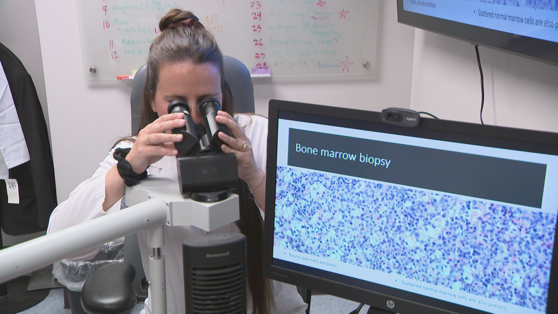 Cellfie Project: Young IWK patients with leukemia get to see disease at cellular level